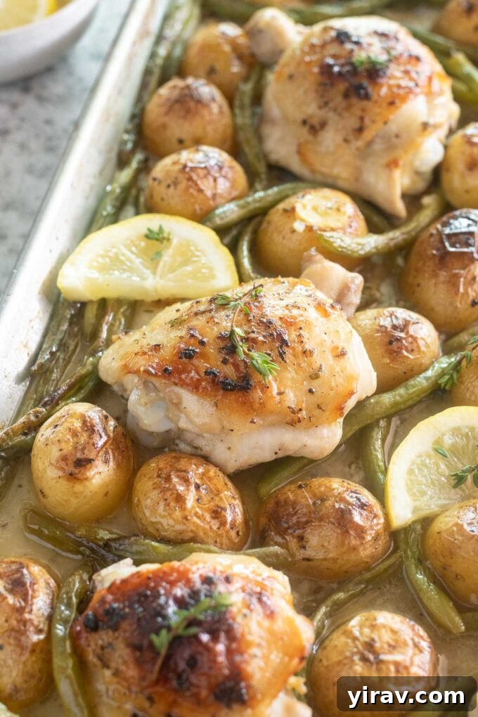 Sheet pan chicken thighs with potatoes and green beans.