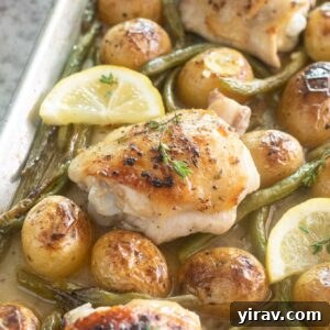 Sheet pan chicken thighs with potatoes and green beans.